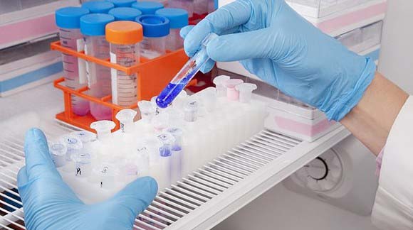 超低溫冰箱 超低溫冰箱解決方案